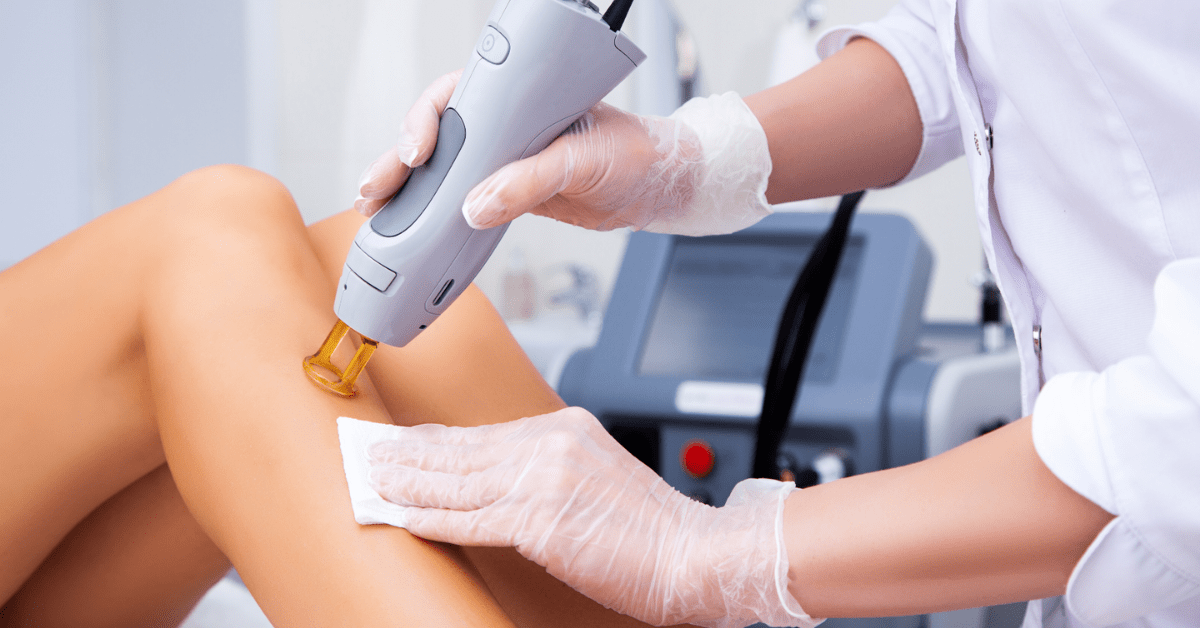 Is Laser Hair Removal Permanent? | First Impressions Clinic