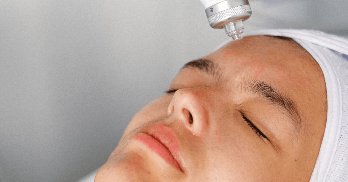 How Microneedling Drastically Improves Your Skin | First Impressions Clinic