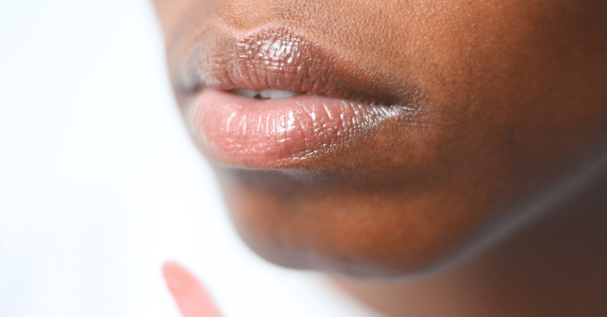 Top Do’s and Don’ts When Getting Lip Fillers | First Impressions Clinic