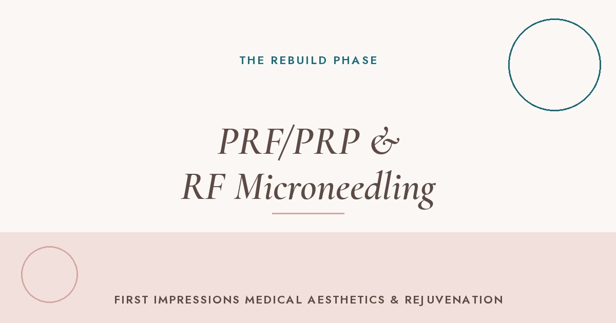PRF/PRP and RF Microneedling treatment supporting collagen rebuilding after summer